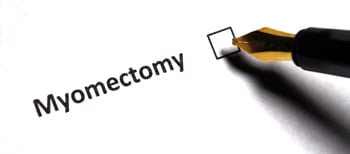 Laparoscopic Myomectomy Outpatient 