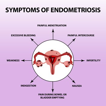 Laparoscopy Endometriosis - Minimally Invasive Treatment