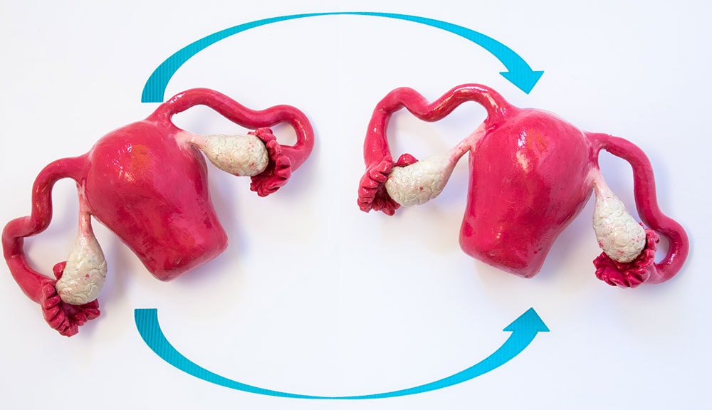 Uterine Transplant